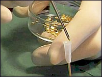 Gold bead implants for humans