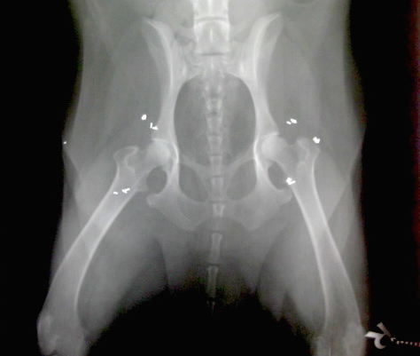 hips with gold bead implants hips with gold bead implants